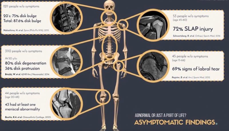 Signes radiologiques vs symptômes