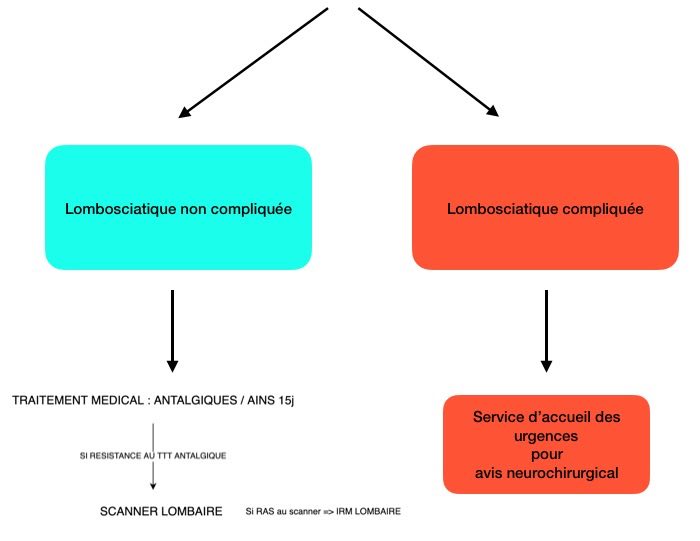 Sciatique : 2 cas de figure