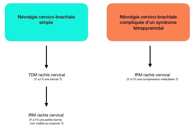 NCB simple ou compliquée