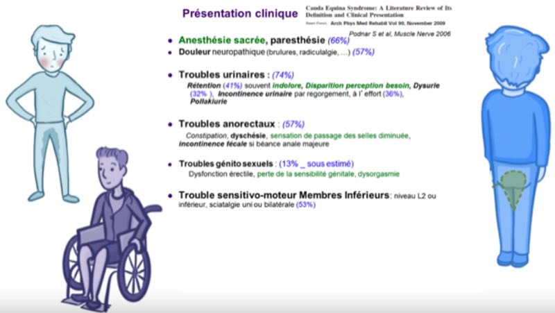 Diagnostic clinique du SdQDC
