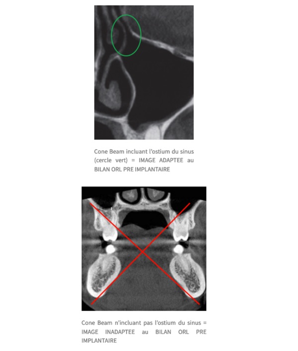 Images CBCT adaptées et non adaptées