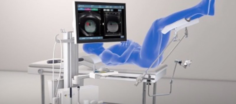 Position du malade lors d’une biopsie echo-IRM guidée