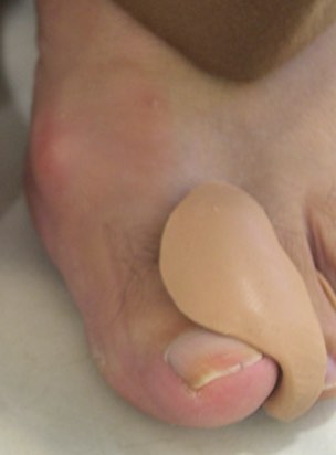 Orthoplastie