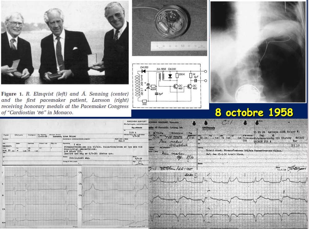 Les 1ers pacemakers