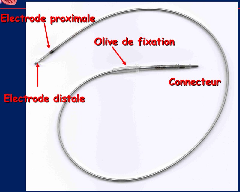 Boitier de PM