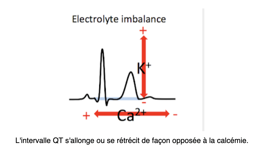 ecg-calcémie