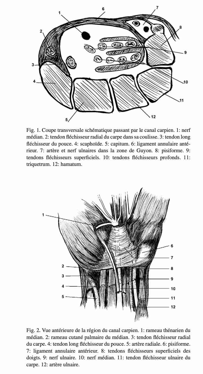 Coupe canal carpien 