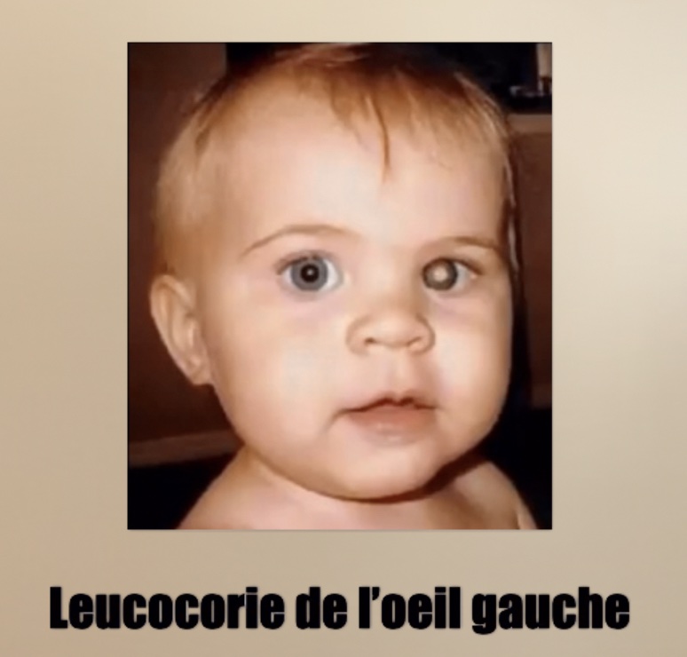 Leucocorie