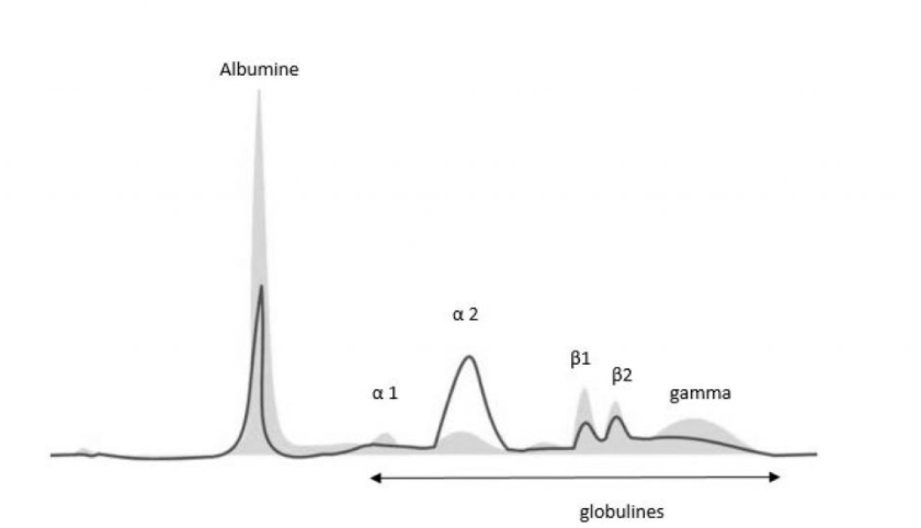 pic alpha2 électrophorèse des protéines