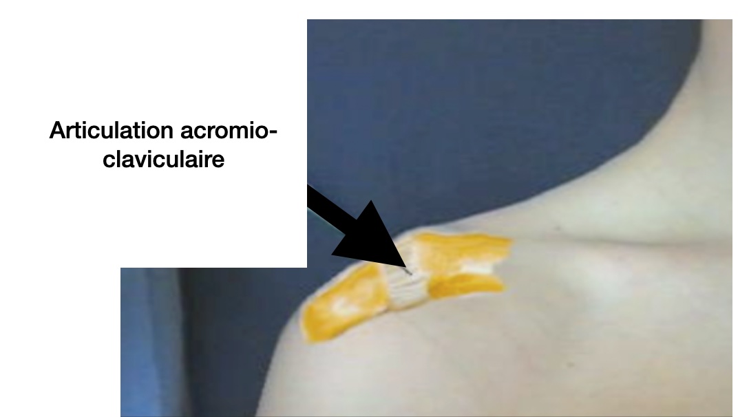 articulation acromio-claviculaire