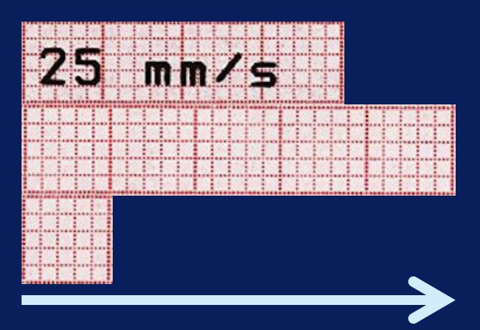 calibrage-temps-ecg-dpc-medecine-generale