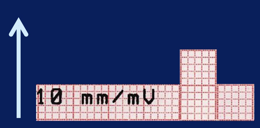 calibrage-voltage-dpc-medecine-generale