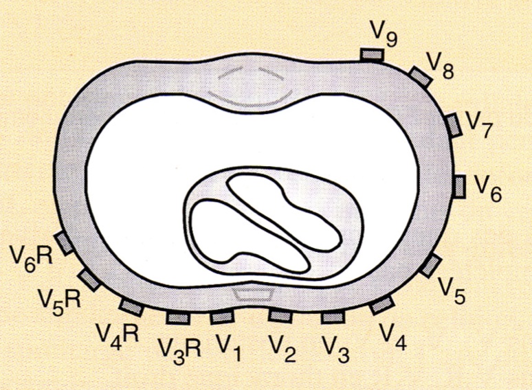 derivation-precordiales-complementaires-ecg-dpc-medecine-generale