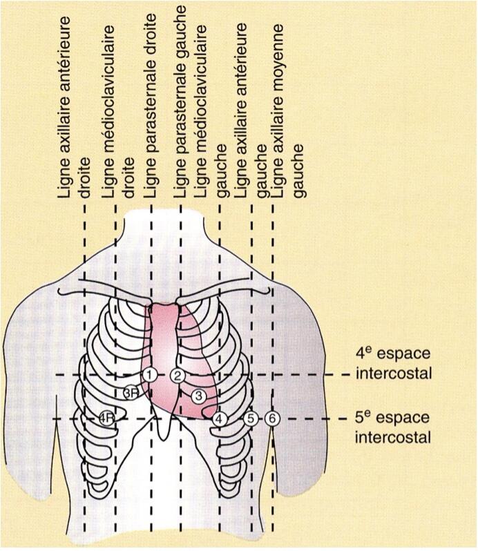 derivation-precordiales-ecg-dpc-medecine-generale