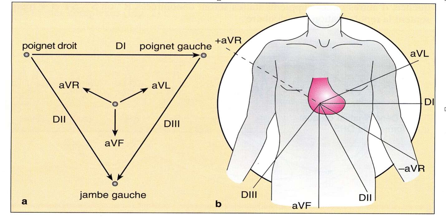 ecg-einthoven-derivation-dpc-medecine-generale