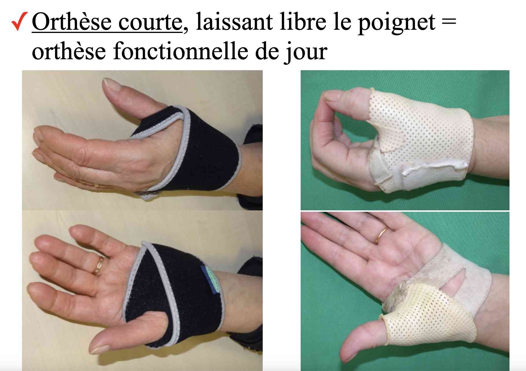 orthese-courte-dpc-mg
