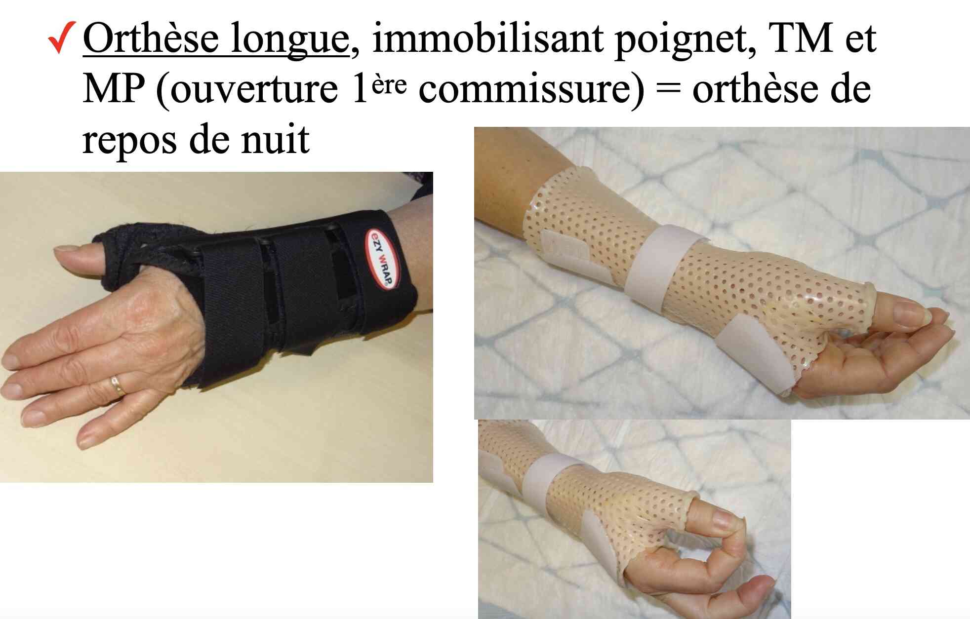 orthese-longue-dpc-pouce-rhizarthrose-mg
