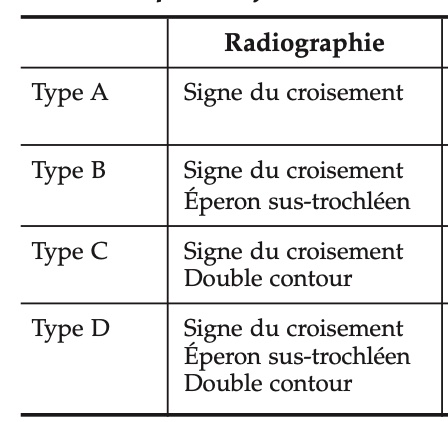 classification-dejour-trochlée