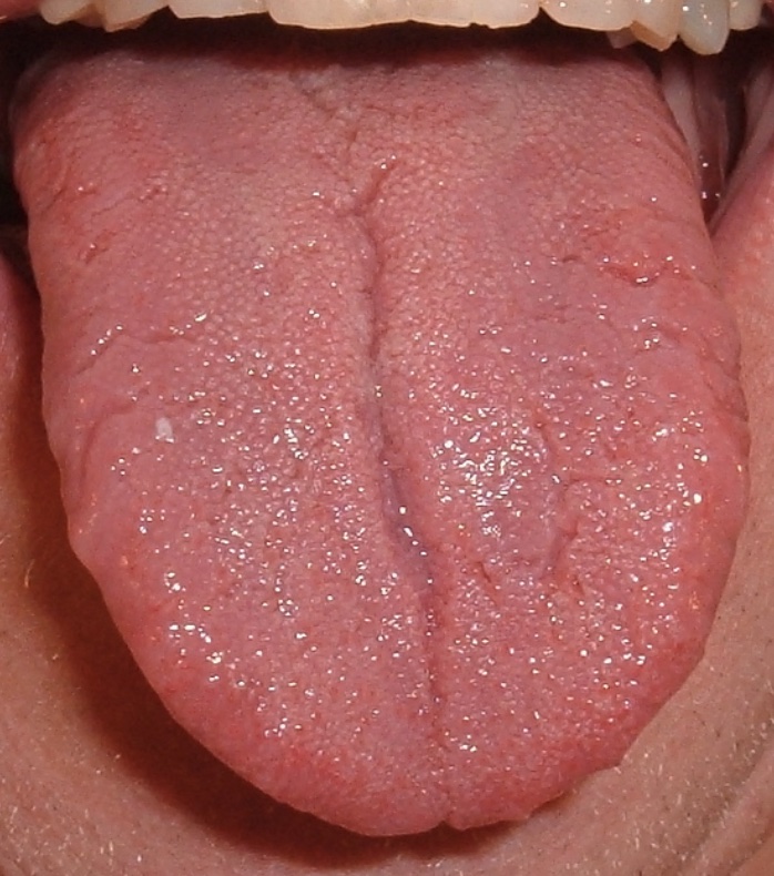 langue-normale-1