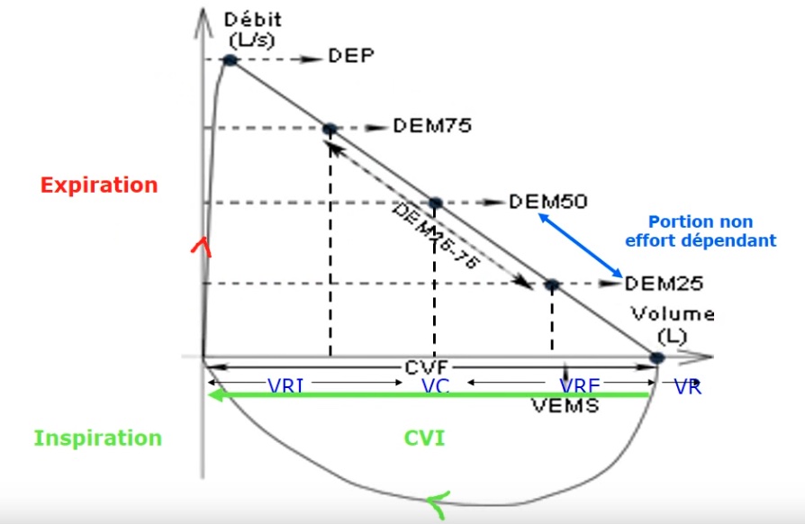 courbe-debit-volume-bpco-mg