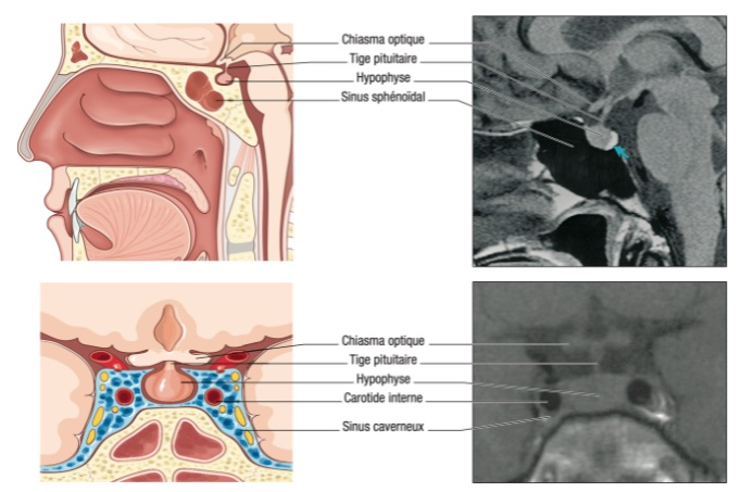 rapports-anatomiques-hypophyse
