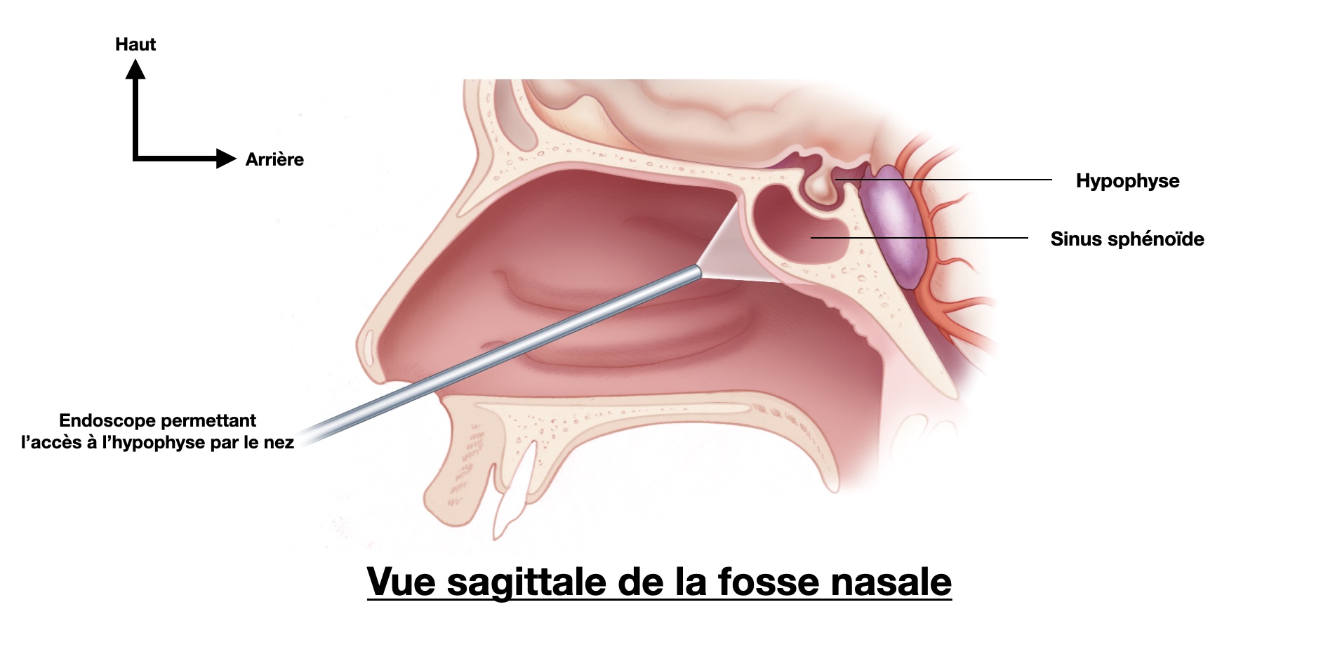 vue-sagittale-nez