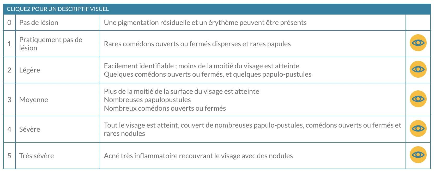 stades-acné