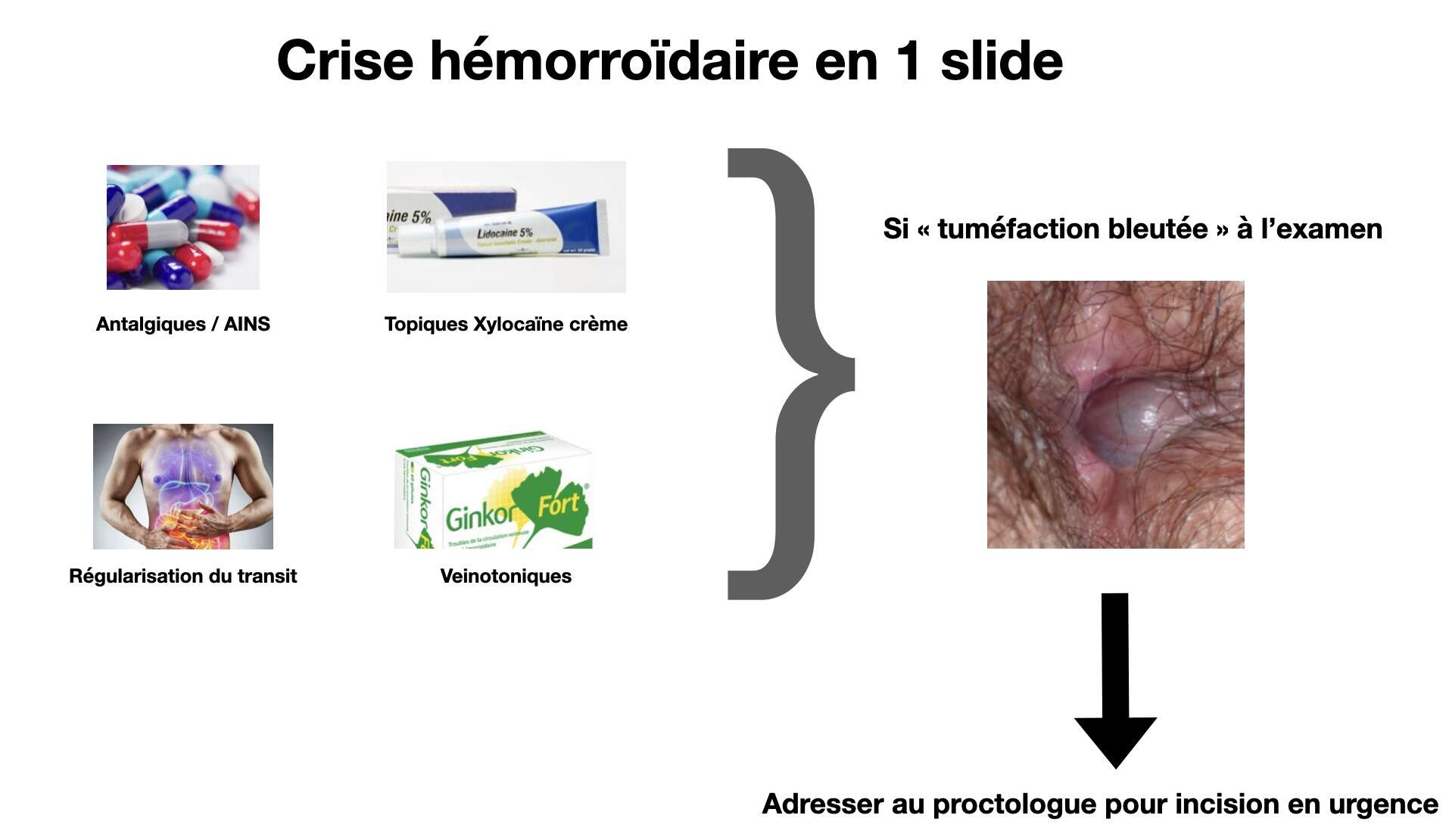 Proctologie en MG