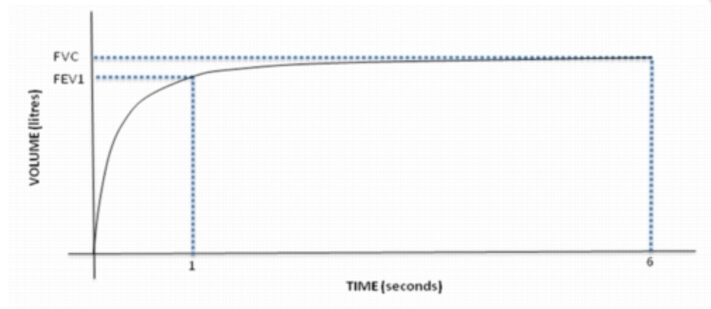 Courbe Volume Temps