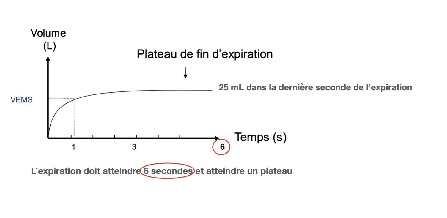Contrôle de la courbe volume/temps