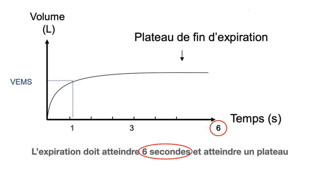 Plateau de fin d'expiration