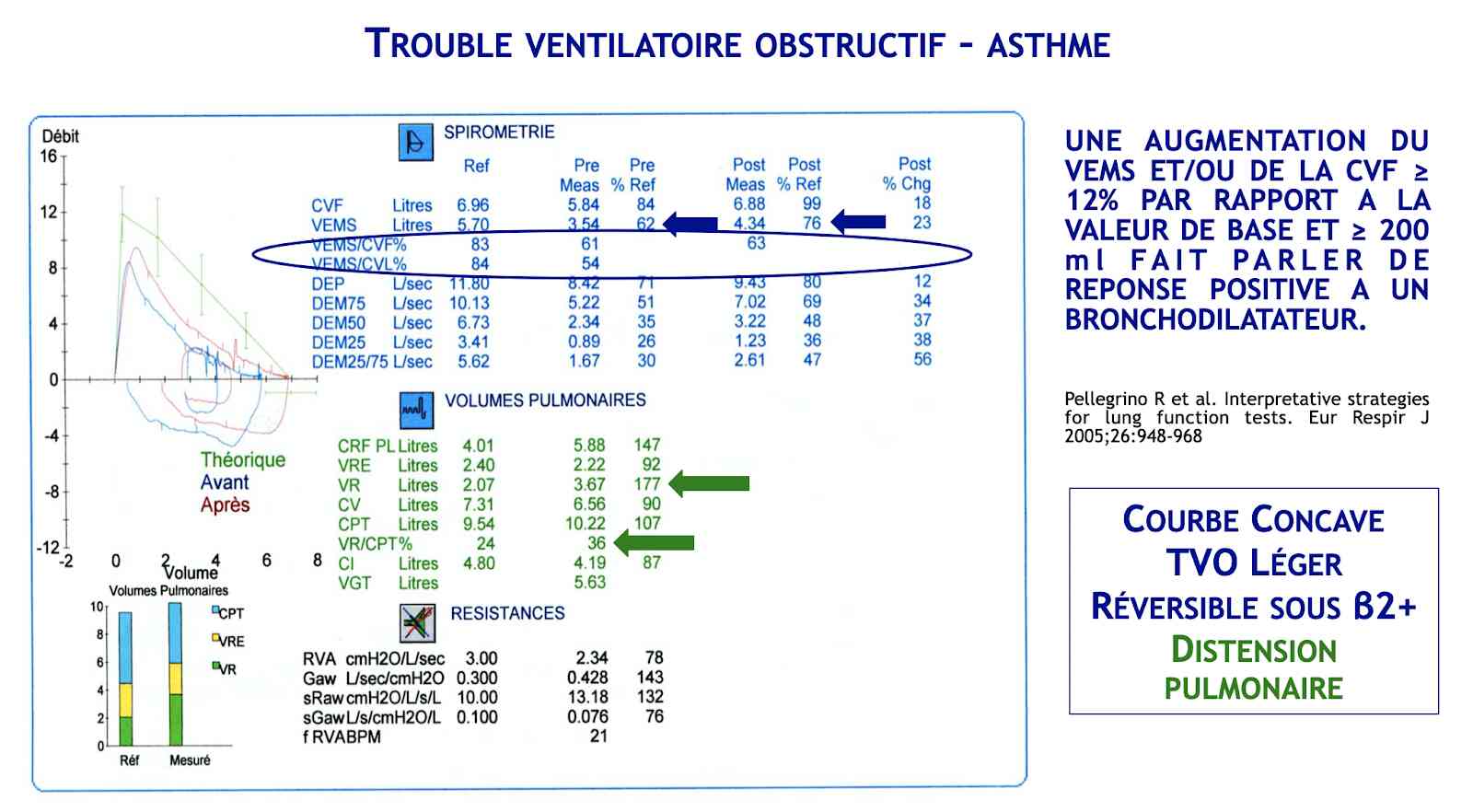 TVO - Asthme