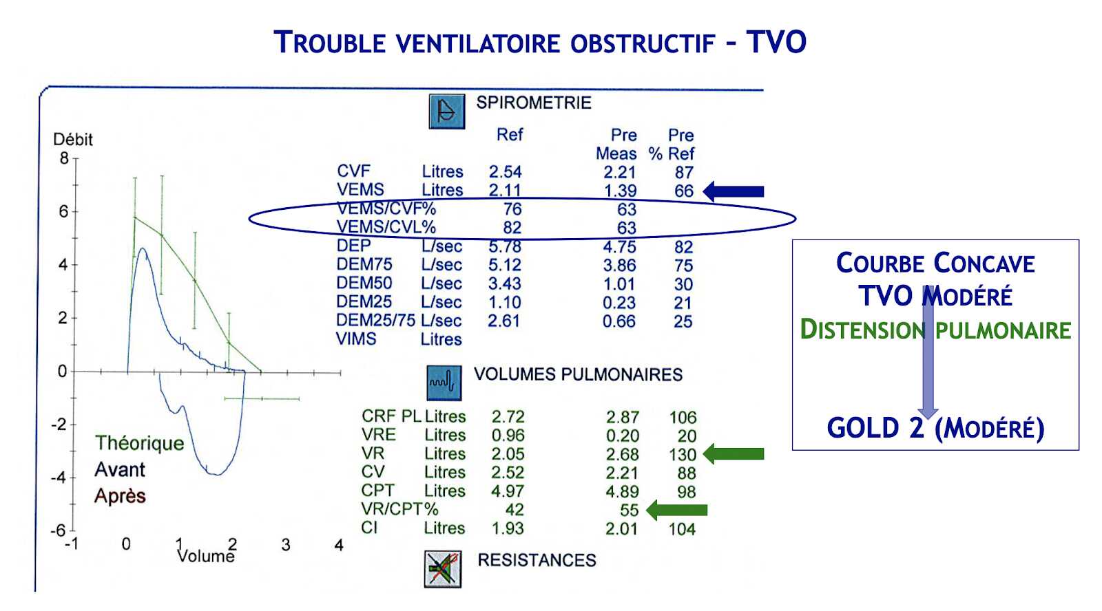 TVO Gold 2