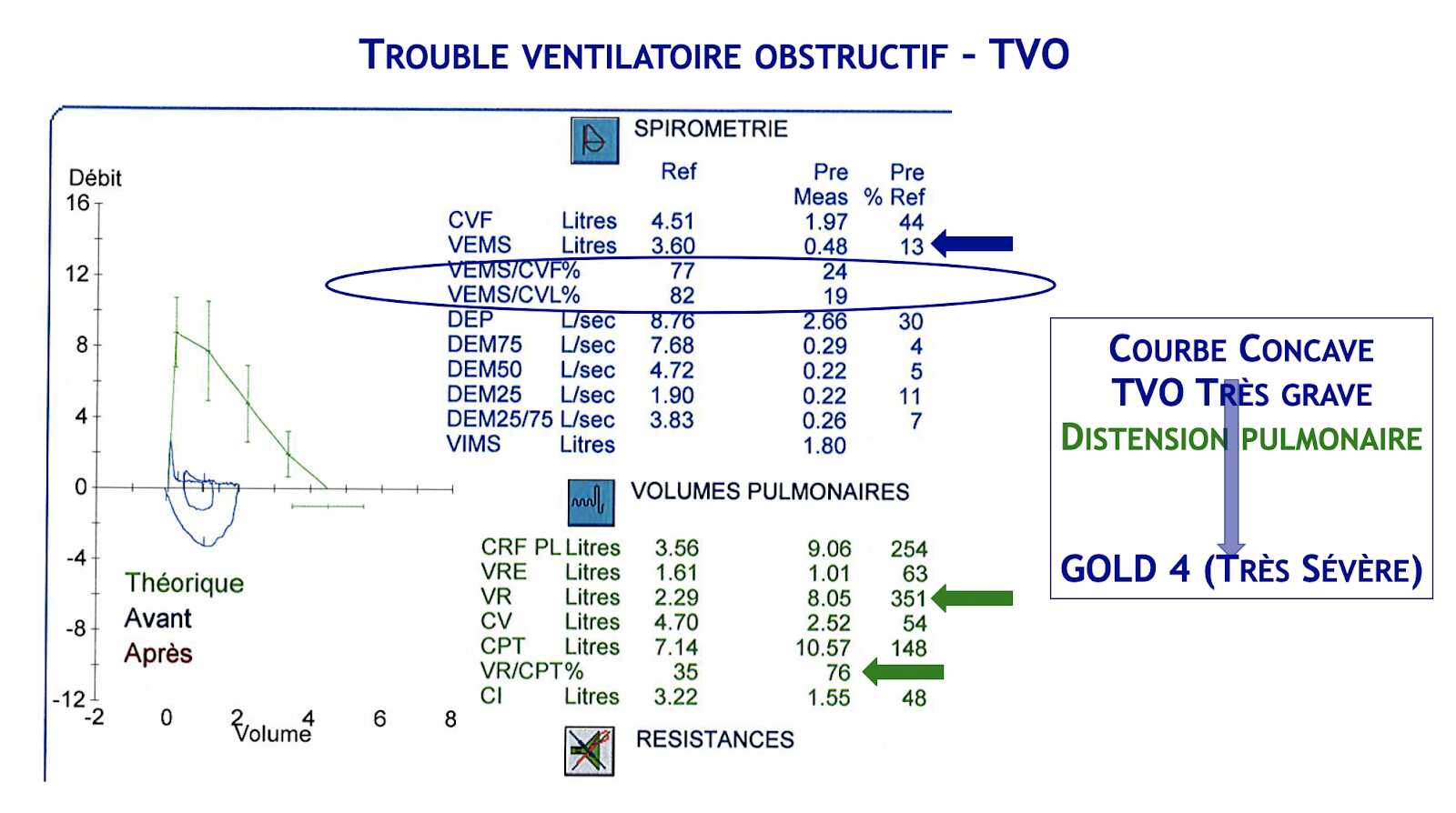 TVO Gold 4