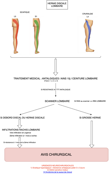 Conduite à tenir en cas de Hernie Discale