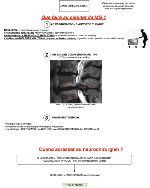 Conduite à tenir en cas de Canal Lombaire Étroit