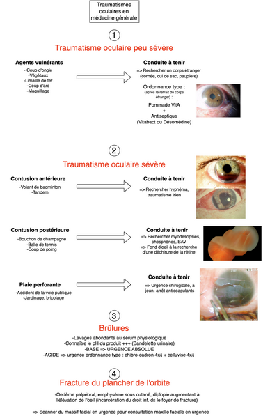 Conduite à tenir devant un traumatisme oculaire 