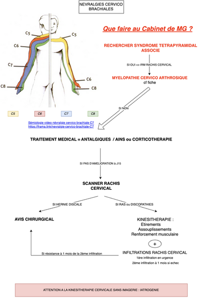Conduite à tenir en cas de Névralgies Cervico Brachiales en ...