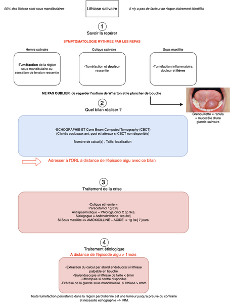 Conduite à tenir face à une lithiase salivaire