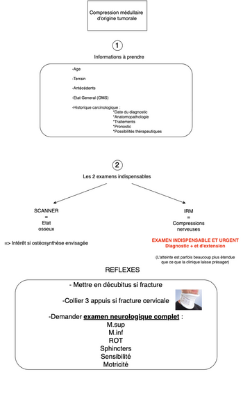 Conduite à tenir face à une compression médullaire d'origine tumorale