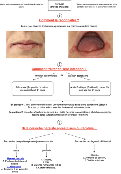 Conduite à tenir devant une perlèche