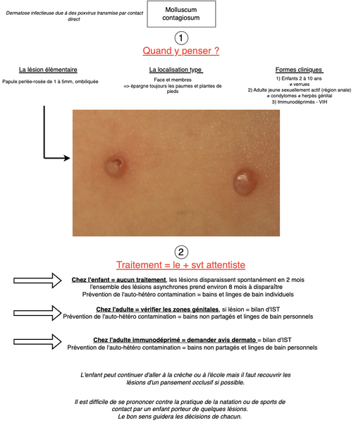 Molluscum contagiosium