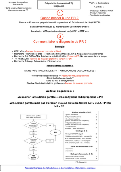 Polyarthrite rhumatoïde 