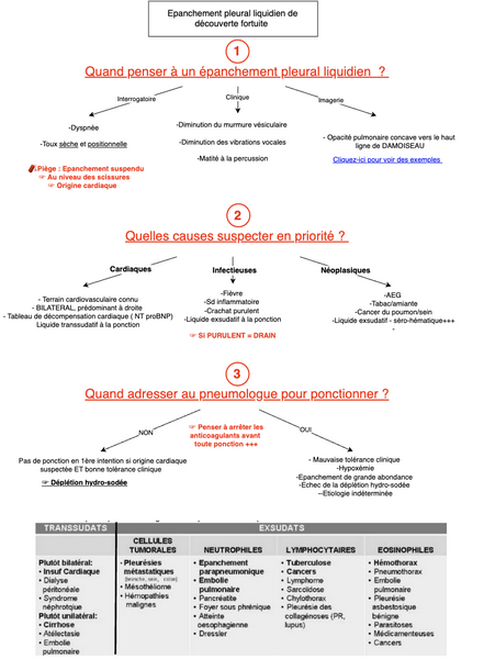 Epanchement pleural