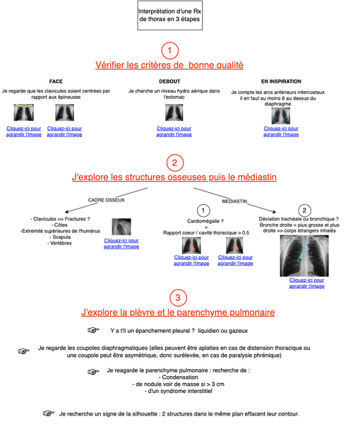 Interprétation radiographie du thorax de face