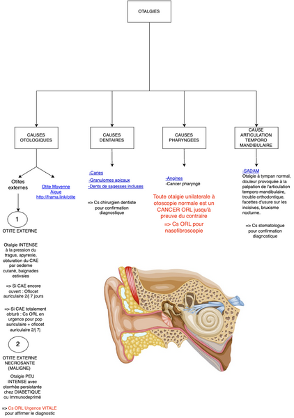 Conduite à tenir en cas d'Otalgies
