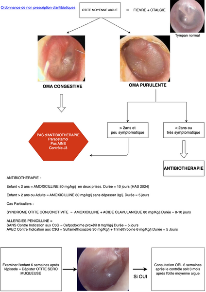 Conduite à tenir en cas d'Otite Moyenne Aiguë