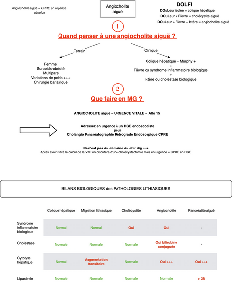 Angiocholite aiguë 