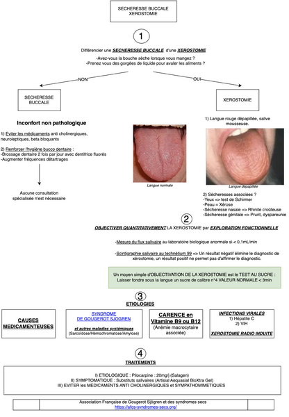 Conduite à tenir en cas de Sécheresse buccale et xérostomie