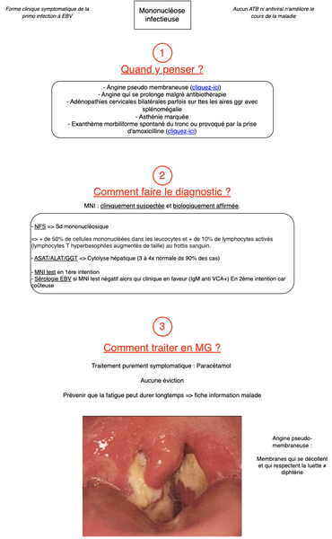 Mononucléose infectieuse